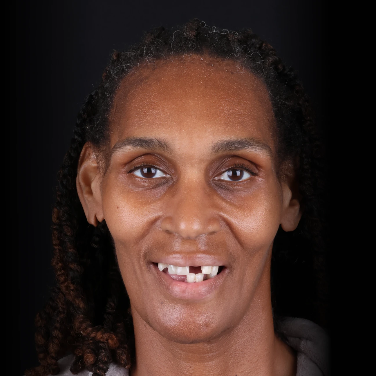 before-dionna